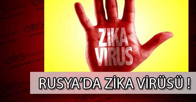 Zika Virüsü Rusya'da da çıktı!